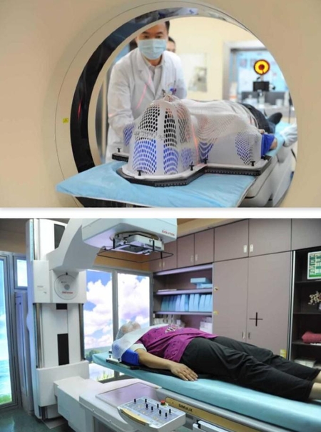 차이나데일리는 중국 중산대 병원이 AI를 종양 제거를 위한 방사선 치료에 활용한 사례가 국제학술지에 실렸다고 전했다./차이나데일리
