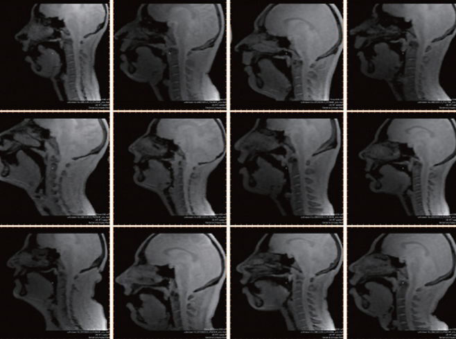 미국 서던캘리포니아대(USC) 연구팀은 래퍼나 비트박서의 현란한 혀 기술의 비밀을 실시간 자기공명영상(MRI) 기술을 통해 확인했다. 사진은 연구팀이 실시간 MRI 기술로 촬영한 비트박서의 구강 내 근육의 움직임. USC 제공