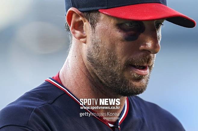 ▲ 20일(한국시간) 필라델피아와 원정경기에 선발 등판한 맥스 슈어저. 만신창이가 된 얼굴로 공 117개를 던진 뒤 승리투수가 됐다.