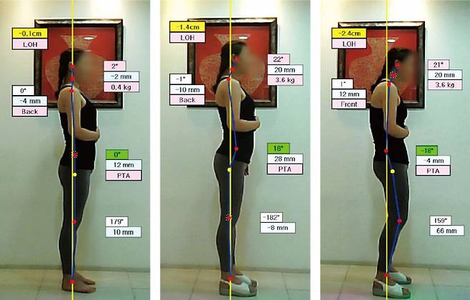 (왼쪽부터)골반이 수직인 자세·골반이 앞으로&nbsp;기울어진 자세·골반이 뒤로&nbsp;기울어진 자세&nbsp;ⓒ 유재욱 제공