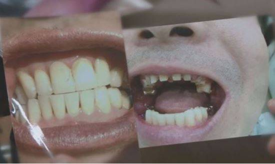 SBS '궁금한 이야기Y' 방송화면 캡처