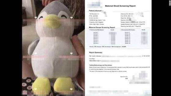 봉제 인형 속에 임신부 혈액 샘플을 숨긴 모습(왼쪽)과 웨이보에 올라온 과거 혈액 테스트 보고서(오른쪽). [사진 CNN 캡처]