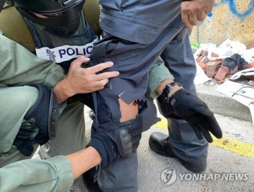 시위대가 쏜 화살에 다리를 맞은 홍콩 경찰 [AFP통신=연합뉴스]