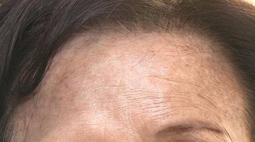 천연 염색약 헤나 부작용 사례. 연합뉴스