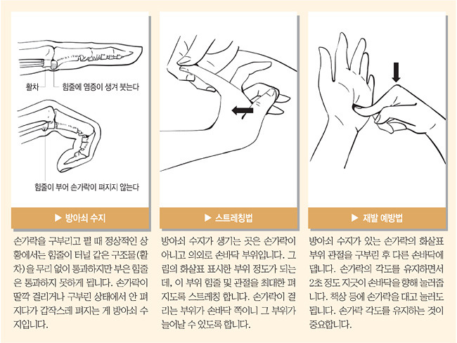 손가락 힘줄·관절, 손등 쪽으로 최대한 펴주고 손가락 구부린 뒤 반대 손바닥 지긋이 눌러줘