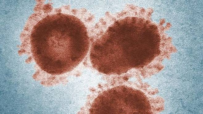 코로나바이러스(코로나19) 전자현미경 사진이다.  CDC 제공