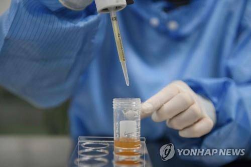 코로나19 검사 키트로 감염 검사를 하는 실험실 [AFP=연합뉴스 자료사진]