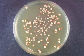 효모균에 생긴 프라이온 [애머스트 UMass 세리오 랩 제공 / 재판매 및 DB 금지]