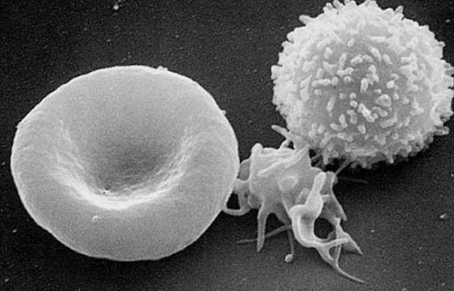 주사 전자 현미경으로 관찰한 적혈구(좌)·혈소판(중)·백혈구(우). 위키피디아 제공