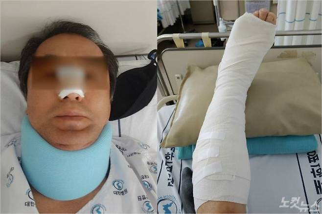 아파트 경비원 고 최희석씨가 피해자로부터 폭행을 당한 후 병원에서 입원 치료를 받던 모습. (사진제공=유족)