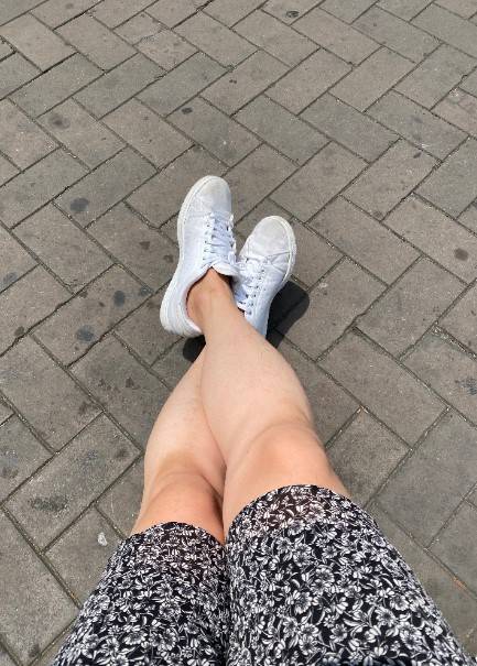 치마를 입고 앉아서 쉬고 있다. 다행히 다리털은 별로 없는 편./사진=남형도 기자