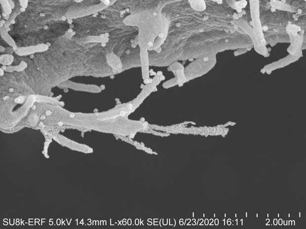 코로나19를 일으키는 ‘SARS-Cov-2’ 바이러스에 감염된 세포의 전자현미경 이미지./사진=UC샌프란시스코(UCSF)