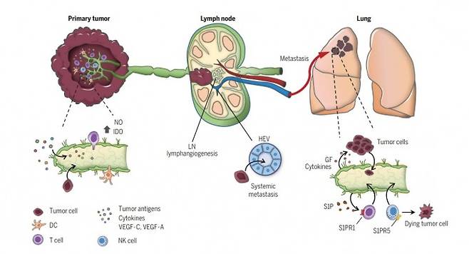 암이 림프관과 림프절을 통해 전이되는 과정을 설명한 그림이다. 암세포른 종양 부근의 림프관이 많으면 안으로 쉽게 들어가고 주변의 면역을 억제한다. 림프관 형성을 촉진하는 VEGF-C(그림 속 작은 점)이 많을수록 전이가 많고 예후도 나쁜 이유다. 반면 림프관을 통해 수지상세포(DC, 그림 속 노란색 별 모양)가 림프절로 이동해 면역 효과를 내는 기능도 한다. 림프관이 많으면 면역세포인 T세포(그림 속 보라색 원)도 잘 침투한다. 고 단장은 "암에서 림프관은 억제와 촉진 기능을 둘 다 한다"고 말했다. 사이언스어드밴시스 논문 캡쳐