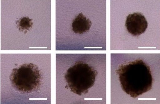 세포 스페로이드를 정밀하게 프린팅하는 '3D 바이오 도트(dot) 프린팅' 기술을 개발한 UNIST 바이오메디컬 공학과 강현욱 교수팀이 세포 농도 및 잉크의 토출 시간 조절을 통해 사이즈가 조절해 세포 스페로이드를 만들었다. UNIST 제공