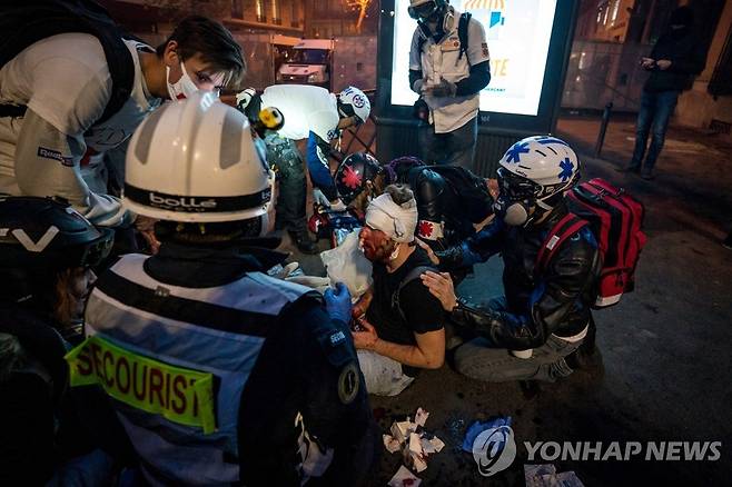 프랑스 보안법 반대 시위 현장을 취재하다 다친 사진기자 [AFP=연합뉴스]