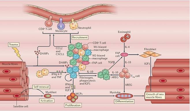 저항 운동이나 충격으로 근육이 스트레스(trauma)를 받으면 신호물질(DAMP)을 내보내 주변의 여러 면역세포를 끌어들인다. 근육의 회복 과정은 꽤 복잡한데, 이 가운데 염증성 대식세포(M1-biased macrophage. 파란색)가 핵심으로 위성세포(satellite cell)에 신호를 보내 증식하고(proliferation) 분화하게(differentiation) 한다. 이때 대식세포가 만드는 글루타민이 결정적인 역할을 한다는 사실이 최근 밝혀졌다. ‘네이처 리뷰스 면역학’ 제공