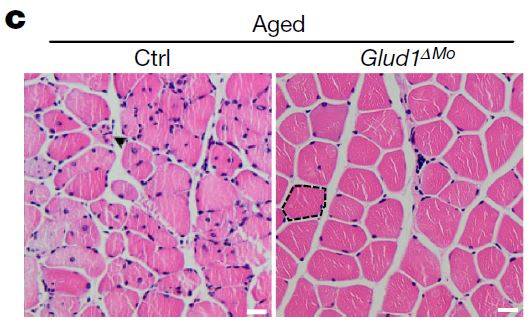 사람으로 치면 60세 노인에 해당하는 생후 18개월 된 생쥐의 근섬유 단면 사진으로 왼쪽이 정상 생쥐이고 오른쪽이 Glud1 유전자가 고장난 변이 생쥐다. 변이 생쥐는 근육의 대식세포가 글루타민을 더 많이 만들어내 근육 노화(감소)가 늦어진 것으로 보인다. 네이처 제공