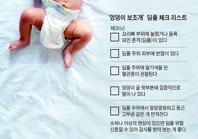 김동석 세브란스병원 소아신경외과 교수는“신생아 엉덩이와 허리 사이 부위가 보조개처럼 움푹 파인 딤플(dimple)은 그 자체로 질환은 아니지만, 척수 기형 등 가능성을 배제할 수 없으므로 조기 검사를 받아야 한다”고 했다. 신생아 10명 가운데 1명이 딤플이 나타난다고 했다. /게티이미지뱅크