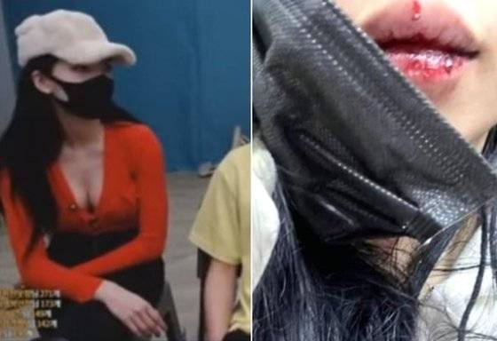 유화가 공개한 데이트 폭력 피해 사진. 아프리카TV