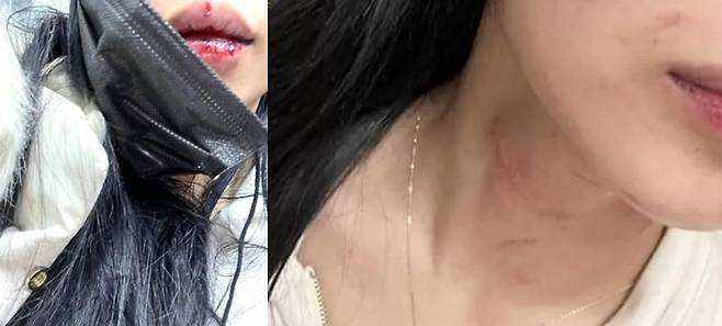 사진=BJ유화 아프리카TV 커뮤니티