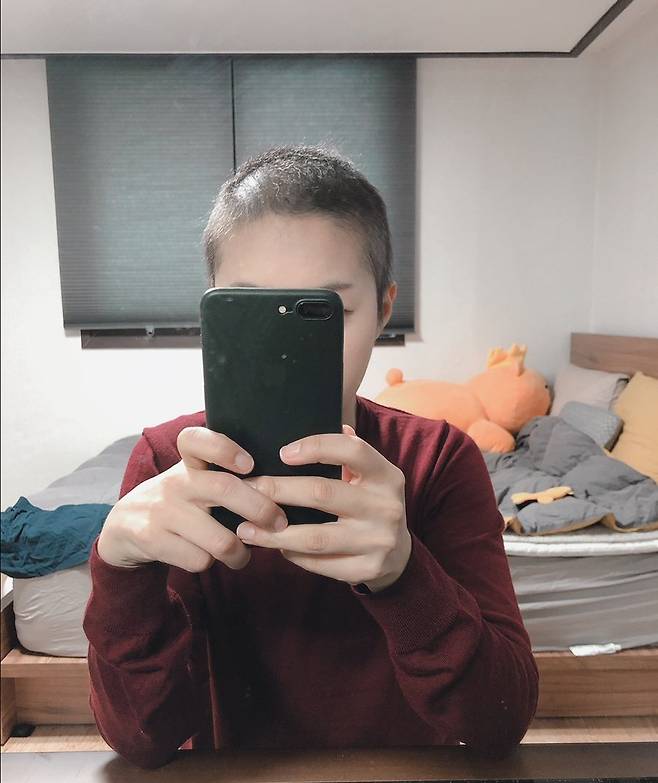 이정은(33)씨가 자신의 블로그에 올린 항암 치료 후 머리가 빠진 사진. 블로그 '흉선암 투병일기'