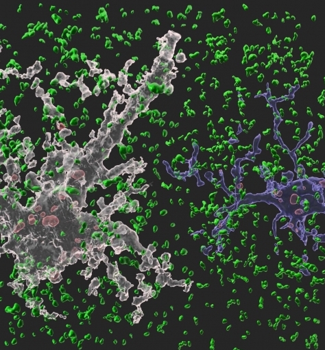 연구팀은 성장한 생체의 뇌에서도 '미세아교세포'보다 '별아교세포'가 더 활발하게 시냅스를 제거하고 있음을 처음으로 밝혀냈다. [사진=삼성전자]