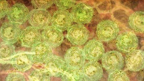 염증 신호를 받아 항체(갈색)를 형성하는 B세포(녹색) [월터 & 엘리자 홀 의학 연구소 제공 / 재판매 및 DB 금지]