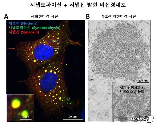 시냅토파이신과 시냅신에 의한 액체-액체 상분리 현상 및 비신경세포에서의 시냅스소낭 응집 모사 구조 형성(미국 예일대 박대훈 박사후연구원 제공) © 뉴스1