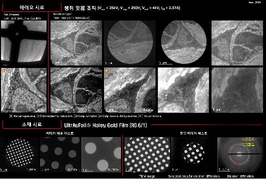 전계방출 투과전자현미경으로 관찰한 생쥐 잇몸 조직 시료 이미지 [한국기초과학지원연구원 제공. 재판매 및 DB 금지]