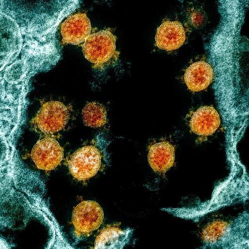 감염 조직에서 분리한 신종 코로나바이러스 입자(오렌지색) [미 NIH 홈페이지 캡처 / 재판매 및 DB 금지]