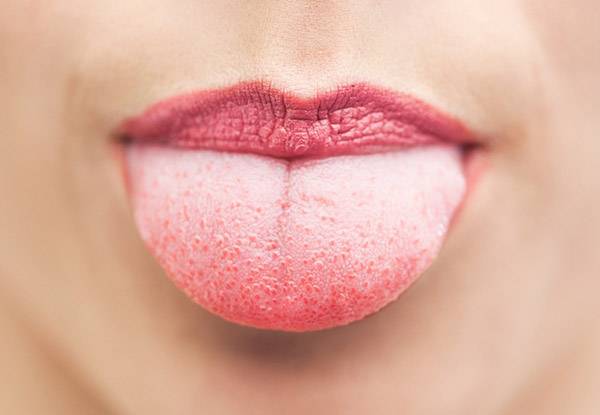 구강작열감증후군은 침이 줄어 입안 점막이 손상됐거나, 폐경 후 여성호르몬이 급감하면서 심해진다. /클립아트코리아 제공