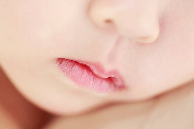 구순염을 방치하면 세균 감염 위험이 높아질 수 있어 주의해야 한다./사진=클립아트코리아