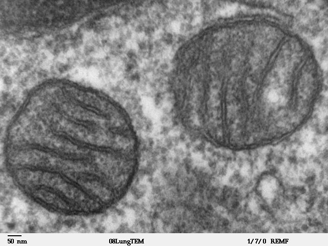 미토콘드리아를 전자현미경으로 봤을 때 모습.(사진=Louisa Howard, Public domain, via Wikimedia Commons)