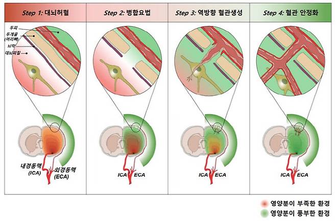 최소침습적 역방향 혈관재생성을 위한 융복합 요법.