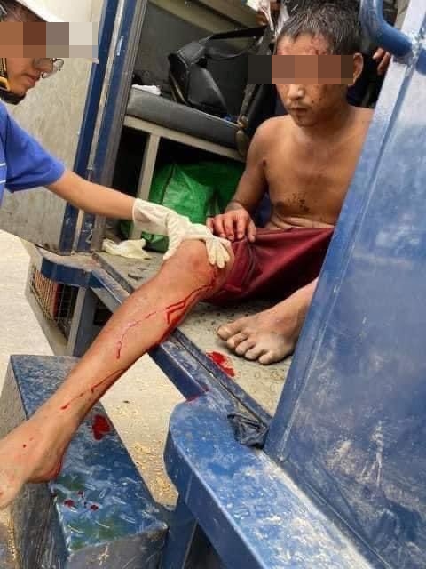 만달레이 시위 도중 무릎에 총상을 입은 남성. [트위터 캡처. 재판매 및 DB 금지]