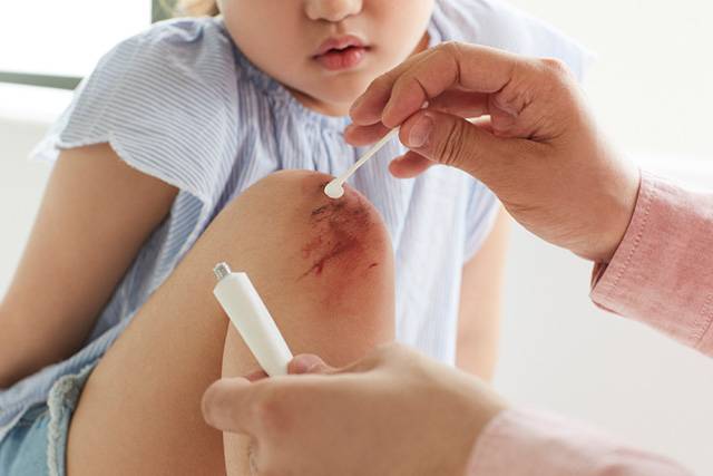 항생제 연고는 내성 우려가 있기 때문에, 사용 기간을 1주일 내로 제한하도록 한다./사진=클립아트코리아