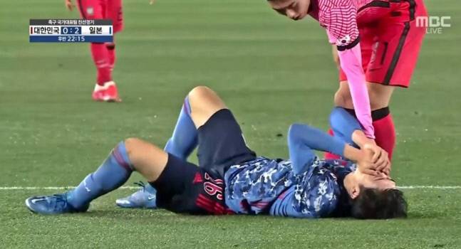 일본 축구대표팀 도미야스가 25일 한·일전에서 이동준의 팔꿈치 가격으로 넘어져 치아를 잡고 괴로워하고 있다. MBC캡처