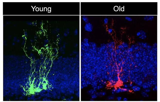 어린 생쥐(녹색)와 늙은 생쥐(적색)의 신경줄기세포. 연합