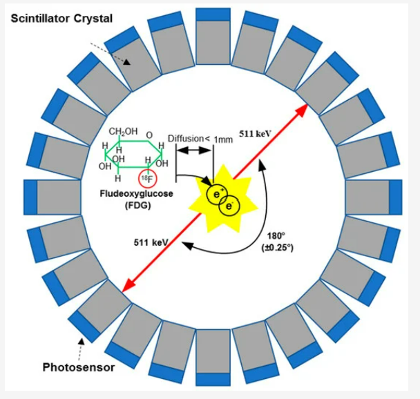 양전자방출단층촬영(PET)의 원리다. 포도당 분자에서 수산기(-OH) 하나가 불소18로 바뀐 불화데옥시포도당(FDG)은 체내에서 반감기가 110분인 불소18이 산소18과 양전자로 바뀐다. 방출된 양전자는 전자를 만나 소멸하면서 질량에 해당하는 고에너지 광자(감마선) 한 쌍을 내놓고 이를 검출해 위치를 추측한다. 센서스 제공