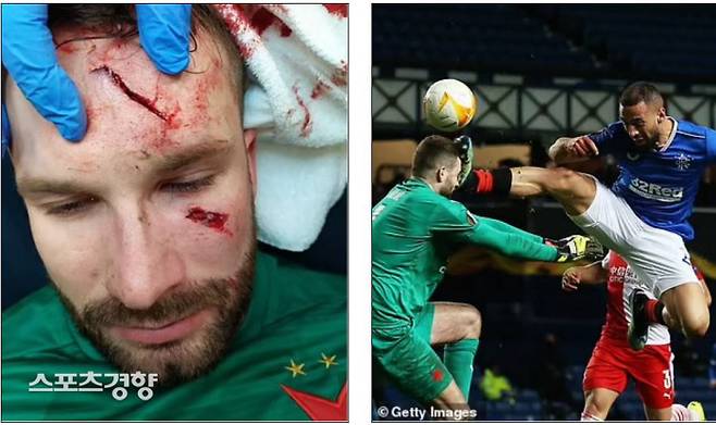 레인저스 케마르 루프가 지난 3월 유로파리그 스파르타 프라하전에서 ‘쿵푸킥’으로 골키퍼 두개골을 골절시키는 부상을 일으켰다. 그는 징계에 항소했으나 UEFA는 4경기 출장정지를 확정했다. 데일리 매일 캡처