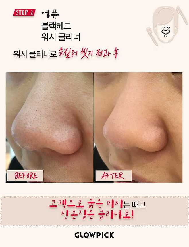 출처: 글로우픽