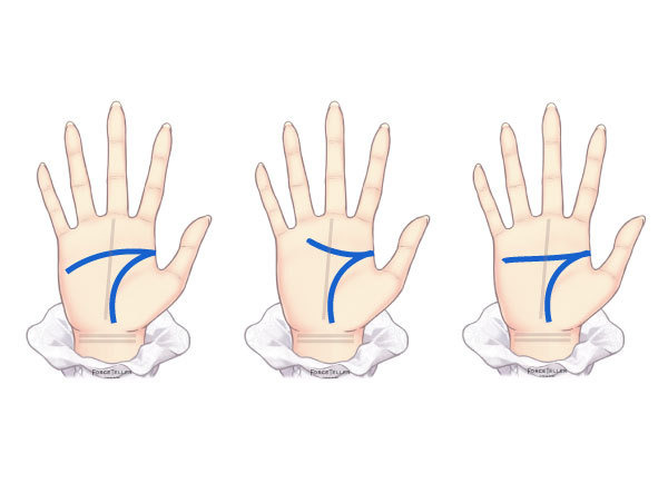 나쁜 손금이라고 알려진 이 손금? | 천기New설 포스텔러