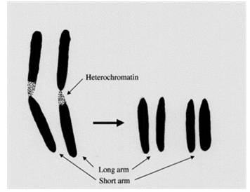 염색체 수에 혼선을 준 염색체 1번의 이질염색체