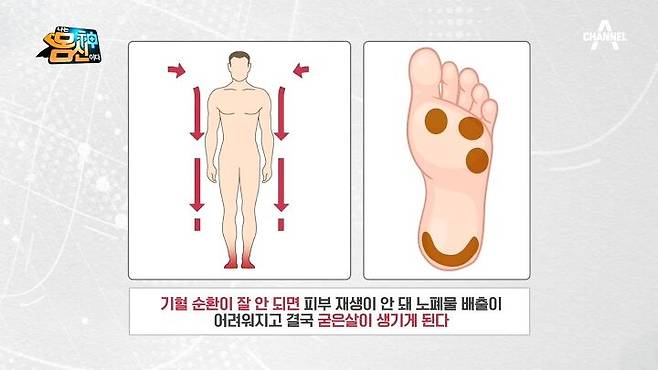 헉..) '발바닥 굳은살'이 보내는 부위별 건강 적신호 | Channela