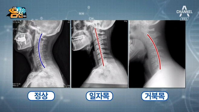 출처: 채널A<나는몸신이다>