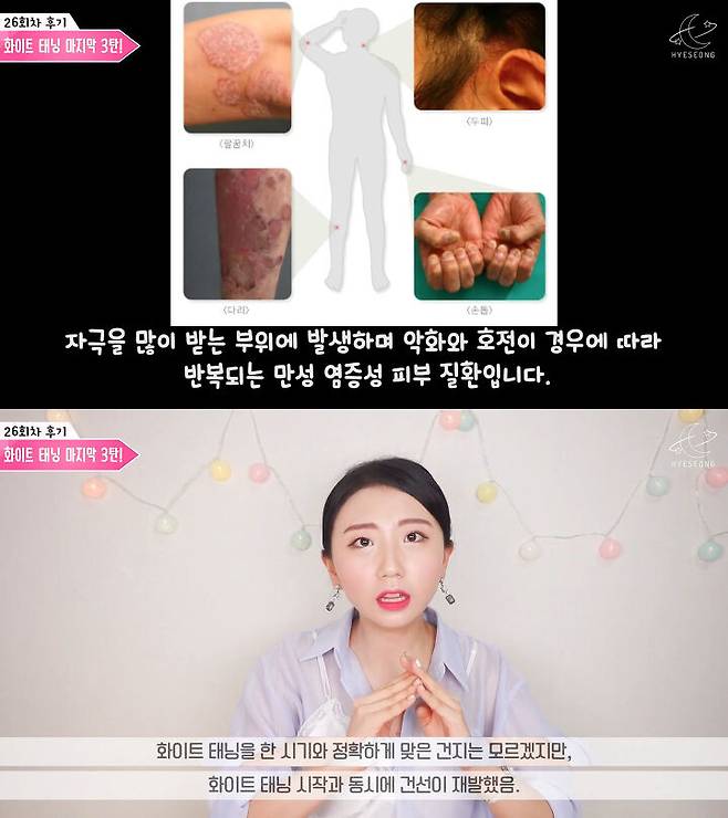 출처: 혜성 Moonbrand 유튜브 채널