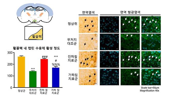 침 치료 후 렙틴 수용체 활성이 증가한 모습 [한국한의학연구원 제공. 재판매 및 DB 금지]