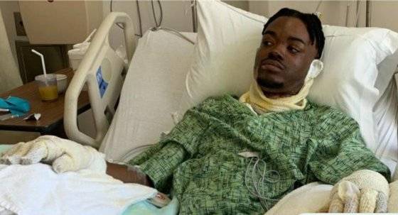 중화상 입고 병원에 입원 중인 남편 윌리엄. 현재 그는 치료비를 마련하기 위한 온라인 모금을 진행하고 있다. 사진 인터넷 모금 사이트 고펀드미