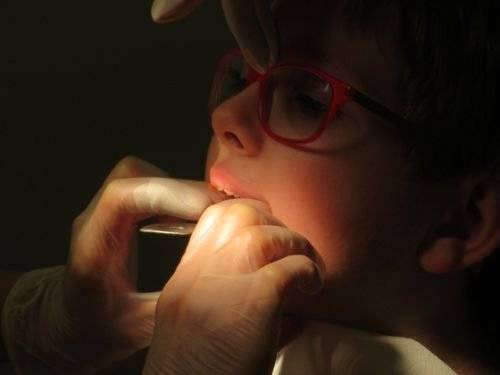 치과용 방사선은 안전하다. 진단을 위해 구내 치근단 방사선 1장 촬영 시의 방사선량은 일상생활 중 자연에서 무심코 하루 동안에 받는 양 정도다. [사진 pixabay]