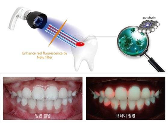 정량광형광기(위). 정량광형광기 검사 전과 후(아래). [자료 전승준]